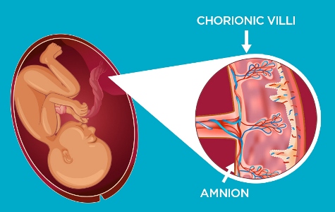 Cells4Life diagram of baby in utero showing the amniotic membrane and chorionic villi