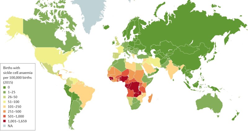 Global Map Sickle Cell Anaemia Births