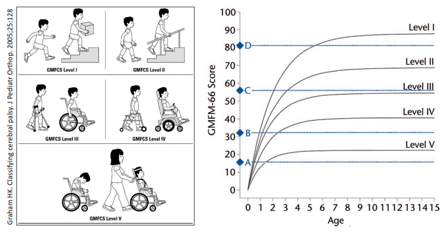 Уровни дцп. ДЦП шкала GMFCS. Классификация больших моторных функций GMFCS. GMFCS шкала при ДЦП для детей до 3. Уровни GMFCS ДЦП.