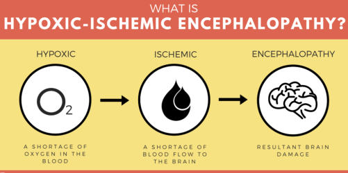 HIE: an ounce of prevention is worth a pound of cure