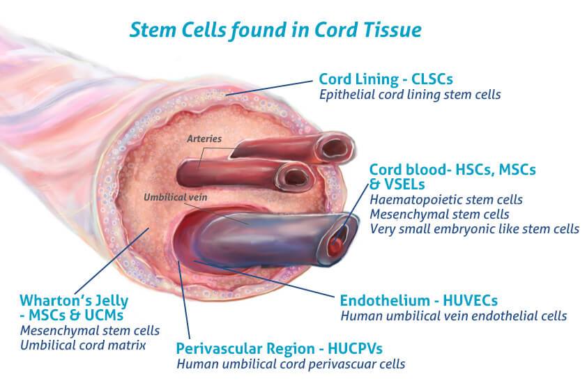 Umbilical Cord Blood: The Superior Source of Stem Cells