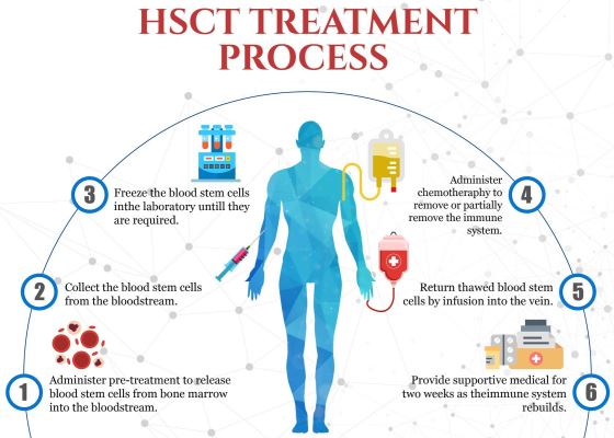 Autologous stem cell transplants for MS procedure