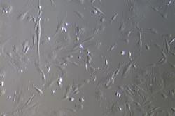 MSC cells extracted from cord tissue