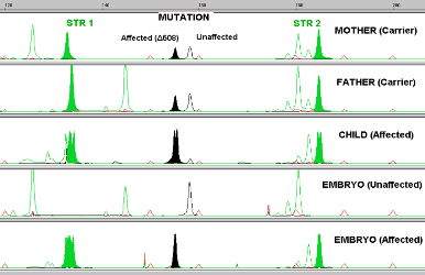 PGD genetic diagnosis