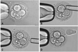 PGD embryo biopsy