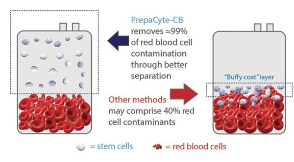 Cryoviva Blessing Plan: cord blood separation with PrepaCyte-CB