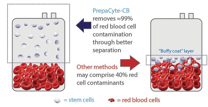 Diagram of red cell depletion with PrepaCyte-CB versus other blood processing methods - courtesy Cryo-Cell