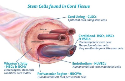 Umbilical Cord Tissue contains multiple types of MSC