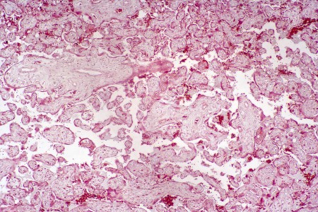 Placenta section. Light micrograph, magnification x25.