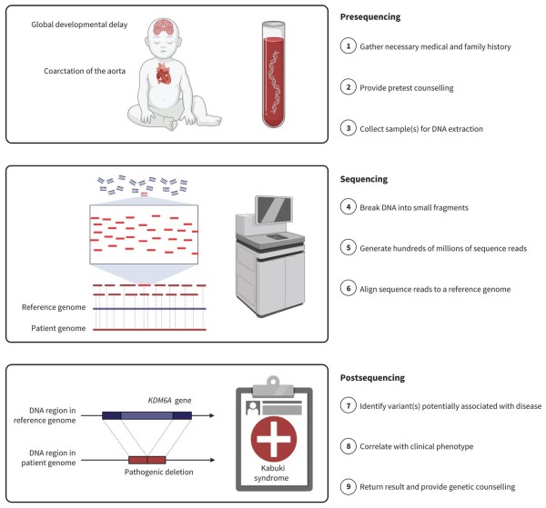 Genome sequencing as a diagnostic test: Costain et al. CMAJ 2021; 193(42):E1626