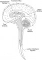 Cerebral Palsy trials against controls MSC therapy Cerebral Palsy trials against controls MSC therapy