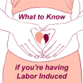 What to Know if you're having Labor Induced