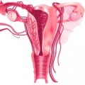 Restoring Women’s Fertility with Birth Tissues