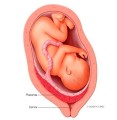 Placenta position and when it matters